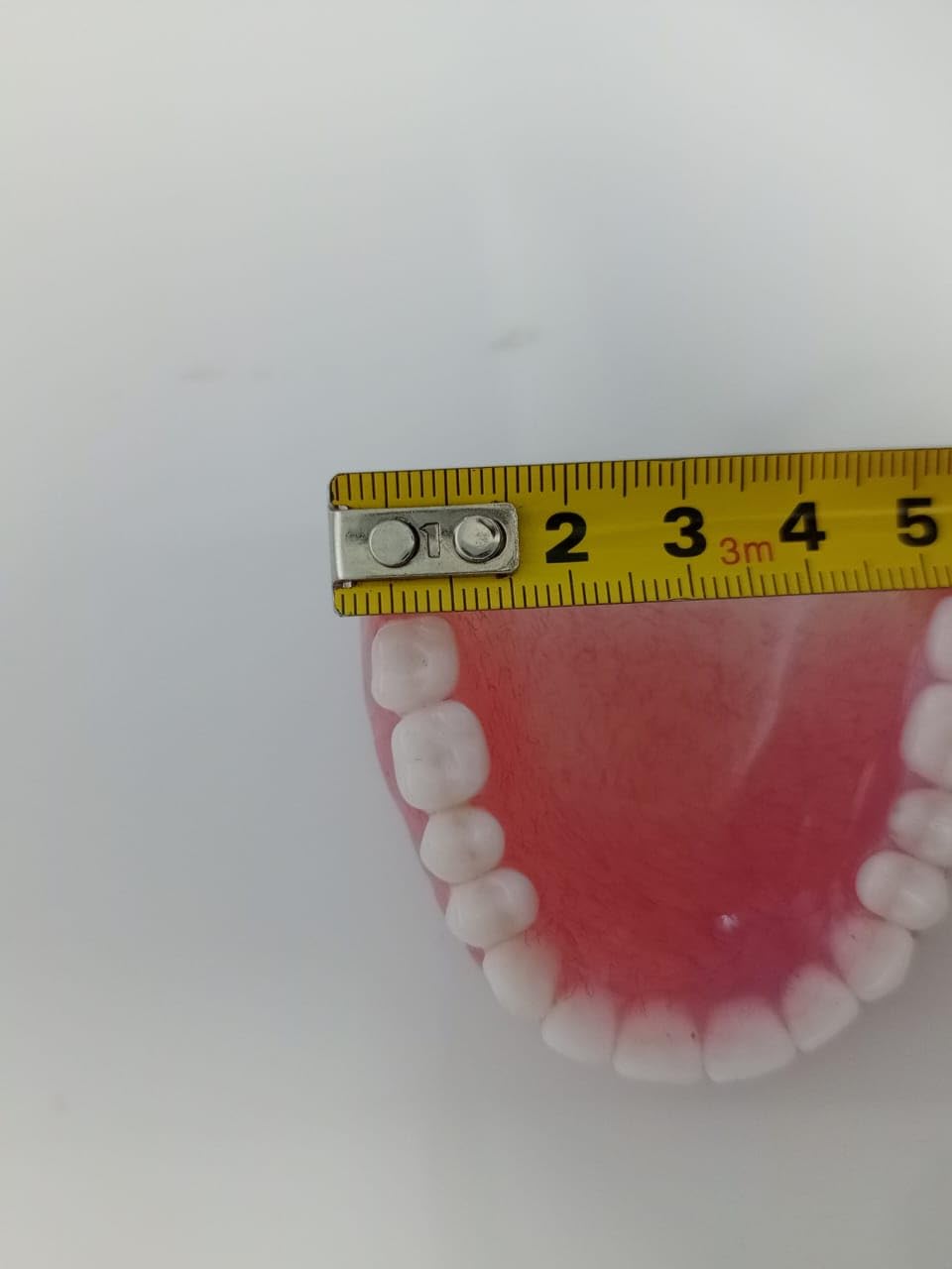 Upper Denture I40194
