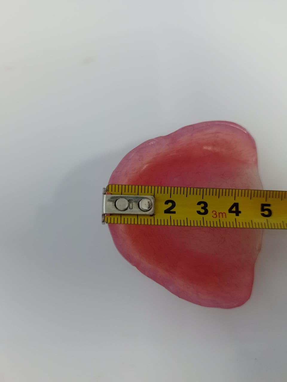 Upper Denture I40194
